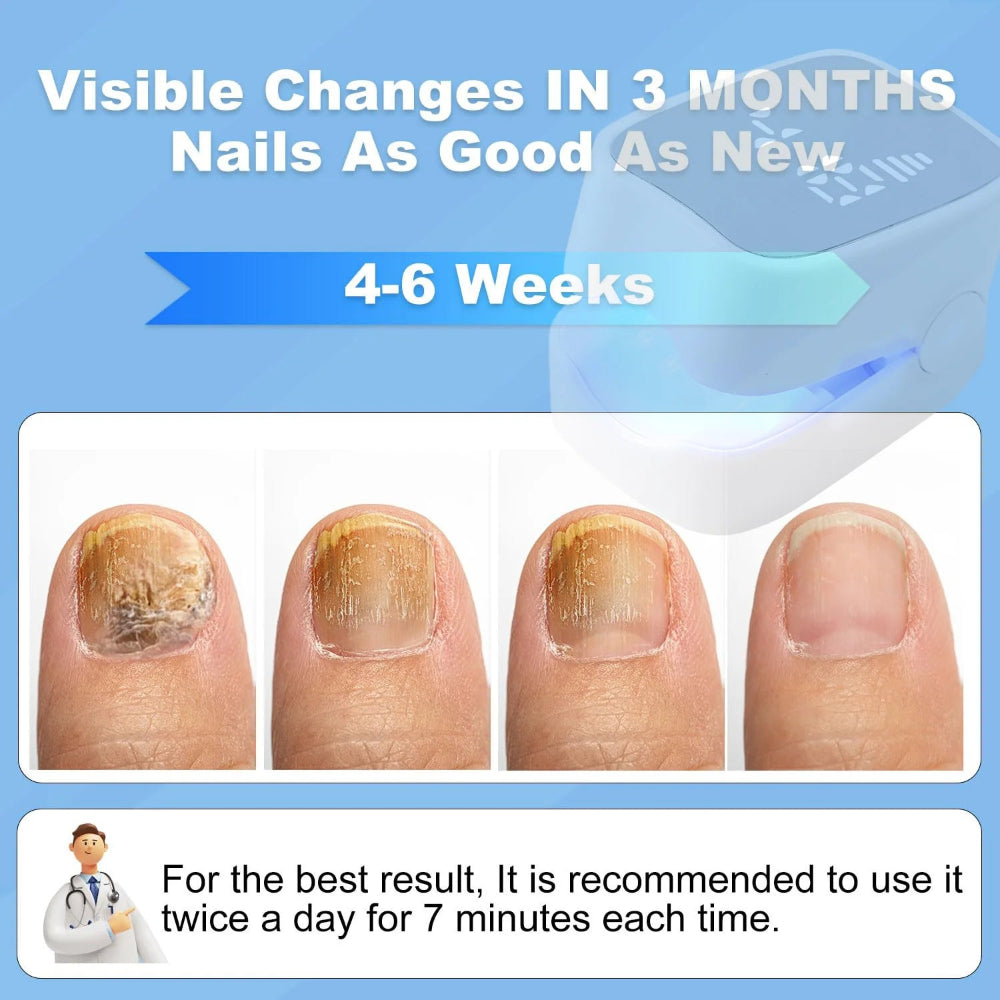 Nail Fungus Cleaning Laser Device