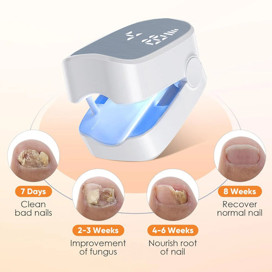 Nail Fungus Cleaning Laser Device