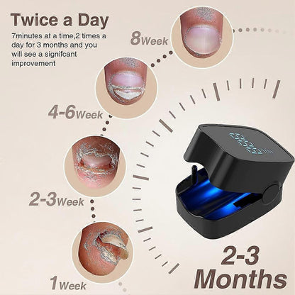 Nail Fungus Cleaning Laser Device